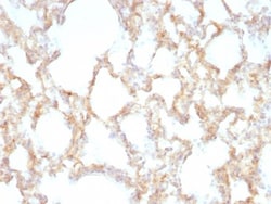 Cytokeratin 7 Antibody (KRT7/1198), Novus Biologicals 0.2mg; Unlabeled:Antibodies,